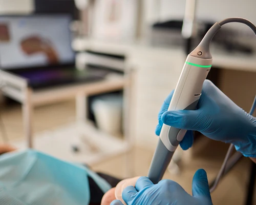 Intraoral Camera