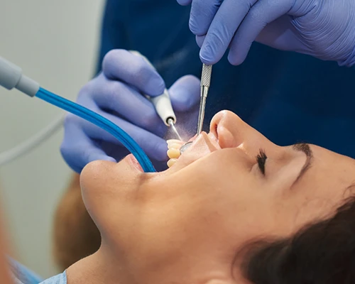 Why Dental Cleanings are Important