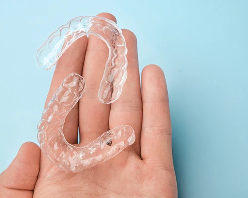 SureSmile Clear Aligners