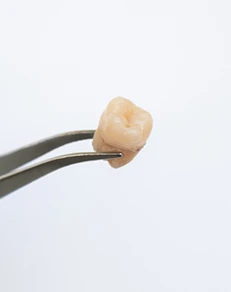 Factors That Affect the Cost of Dentures