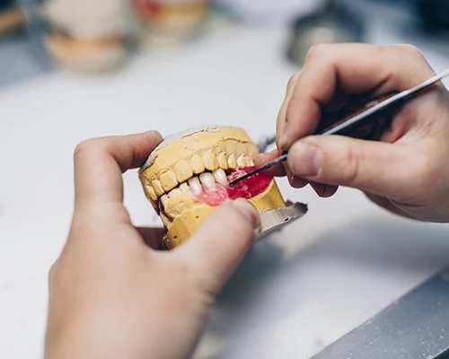 How Dentures are Made