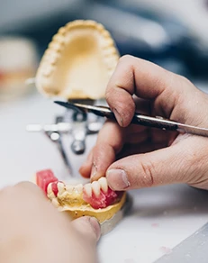 The Denture Creation Process