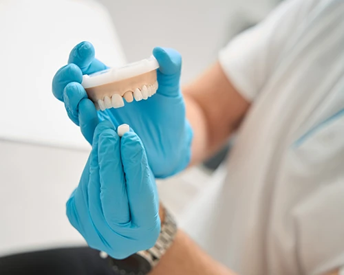 What is a Dental Crown?