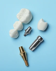 The Parts of Your Dental Implant