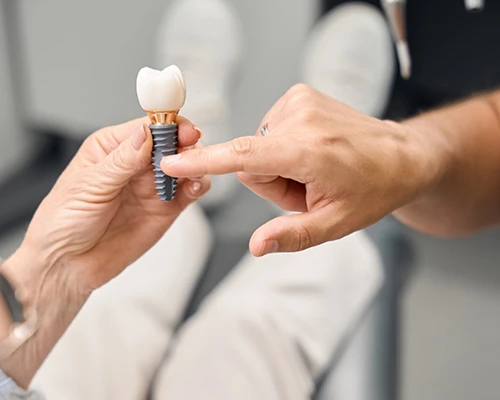 What is a Dental Implant?