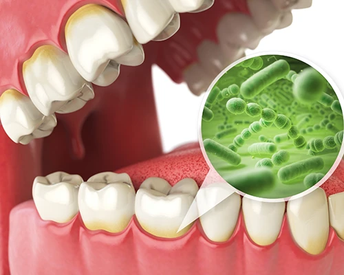 Antibiotic Treatment