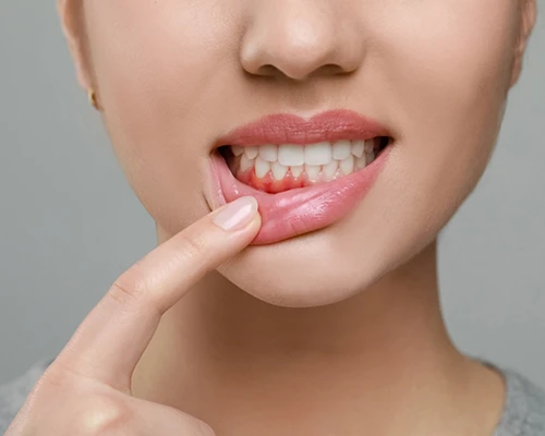 How Do We Treat Gum Disease?