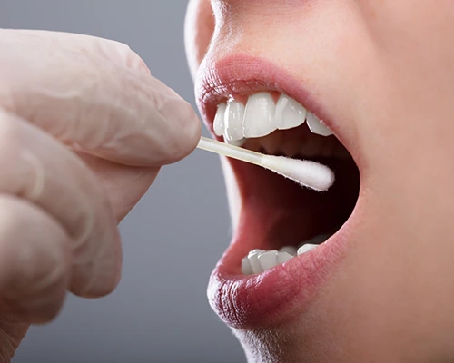 Oral Cancer Screening