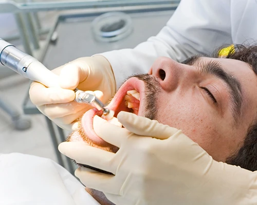 Fluoride Treatment