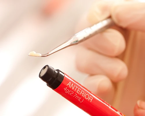 How Do Tooth-Colored Fillings Work?