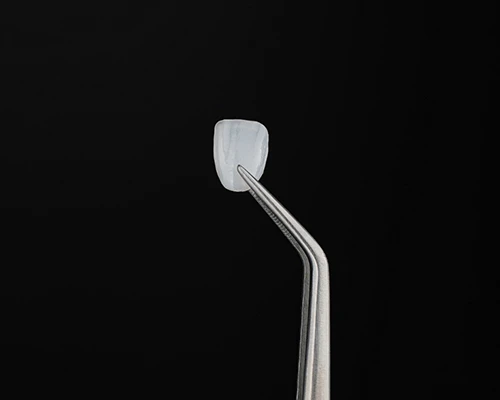 What are Dental Veneers?