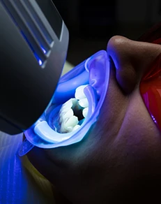 Cost vs. Cosmetic Dentistry: What’s Right for Me?